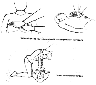 REANIMACIÓN Y RESPIRACIÓN CARDIACA 