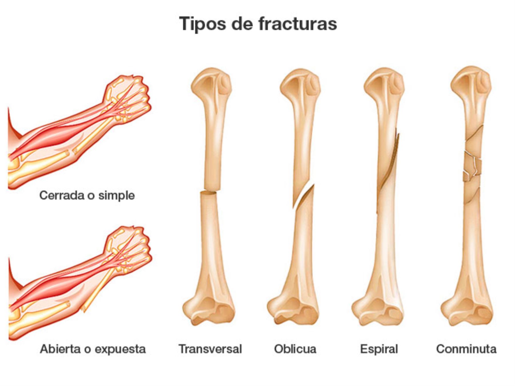 Mapa De Falhas O Fracturas Download Scientific Diagram - Bank2home.com